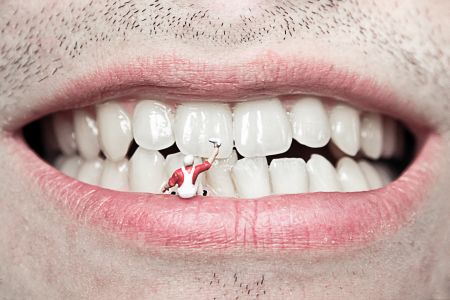 Schaubild einer Zahnsanierung